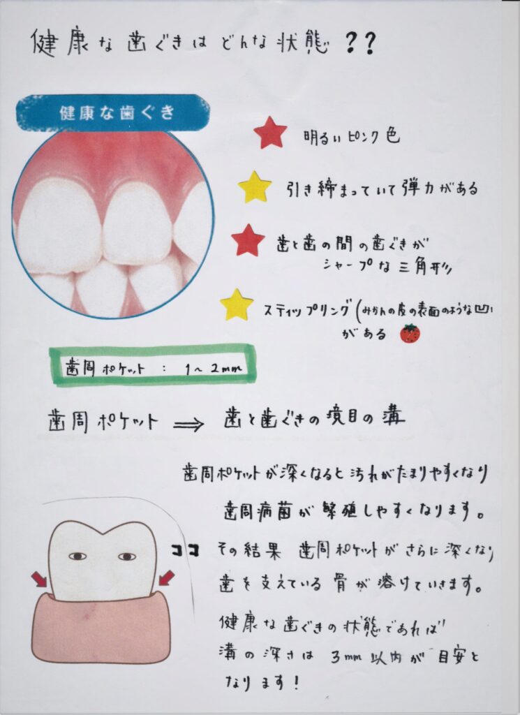 【新生会NEWS】健康な歯ぐきの見分け方